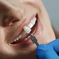 icone-faceta-dental